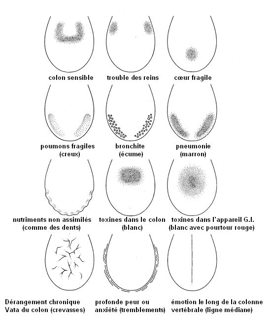 Quelques types de d&eacute;sordres et leurs manifestations